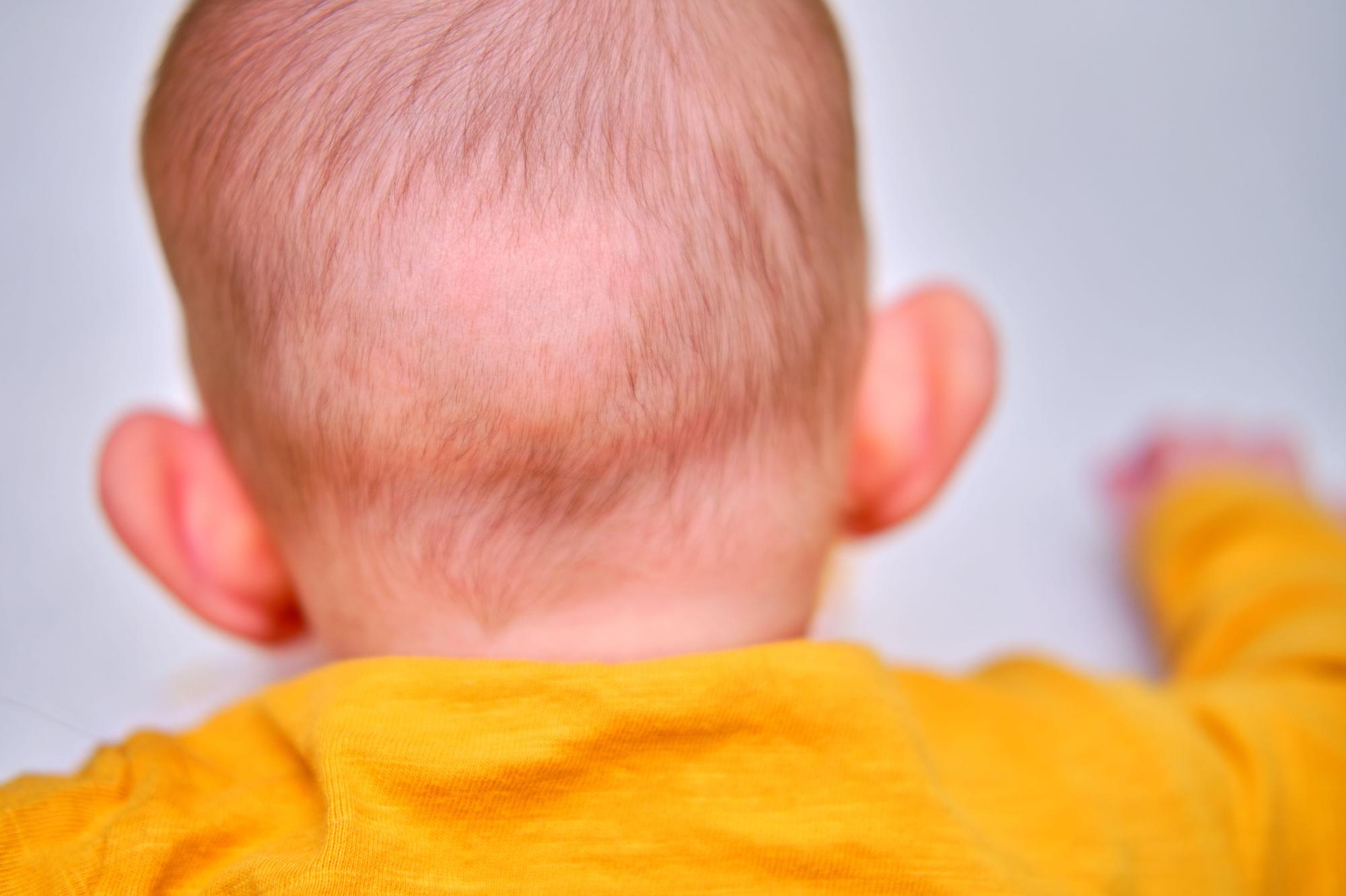 Почему у ребенка не растут волосы? | Мамоведия - о здоровье и развитии ребенка